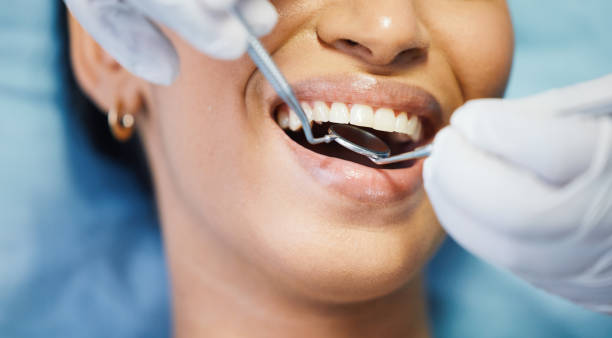 Best Knocked-Out Tooth Emergency  in Royal Palm Beach, FL